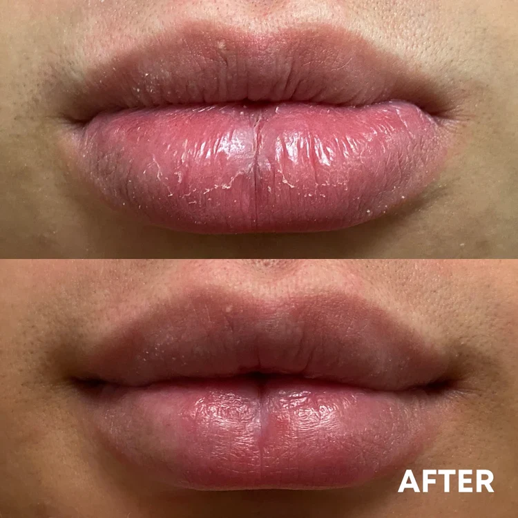 Doğru kullanım standardı görseli